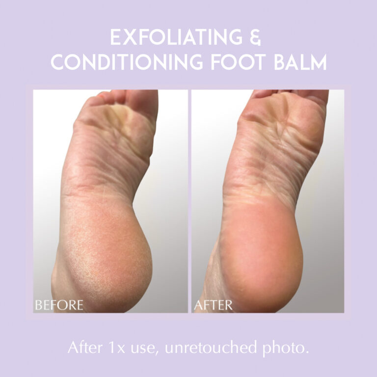 Billede til sociale medier Exuviance Exfoliating & Conditioning Foot Balm 1
