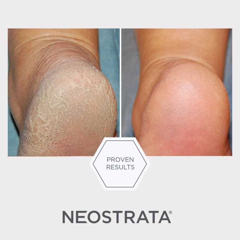Billede til sociale medier NEOSTRATA Problem Dry Skin Cream 1