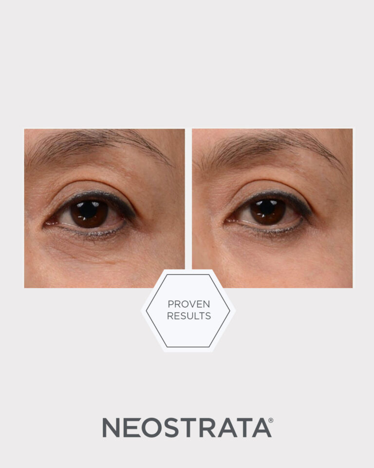 Billede til sociale medier NEOSTRATA Intensive Eye Therapy 1