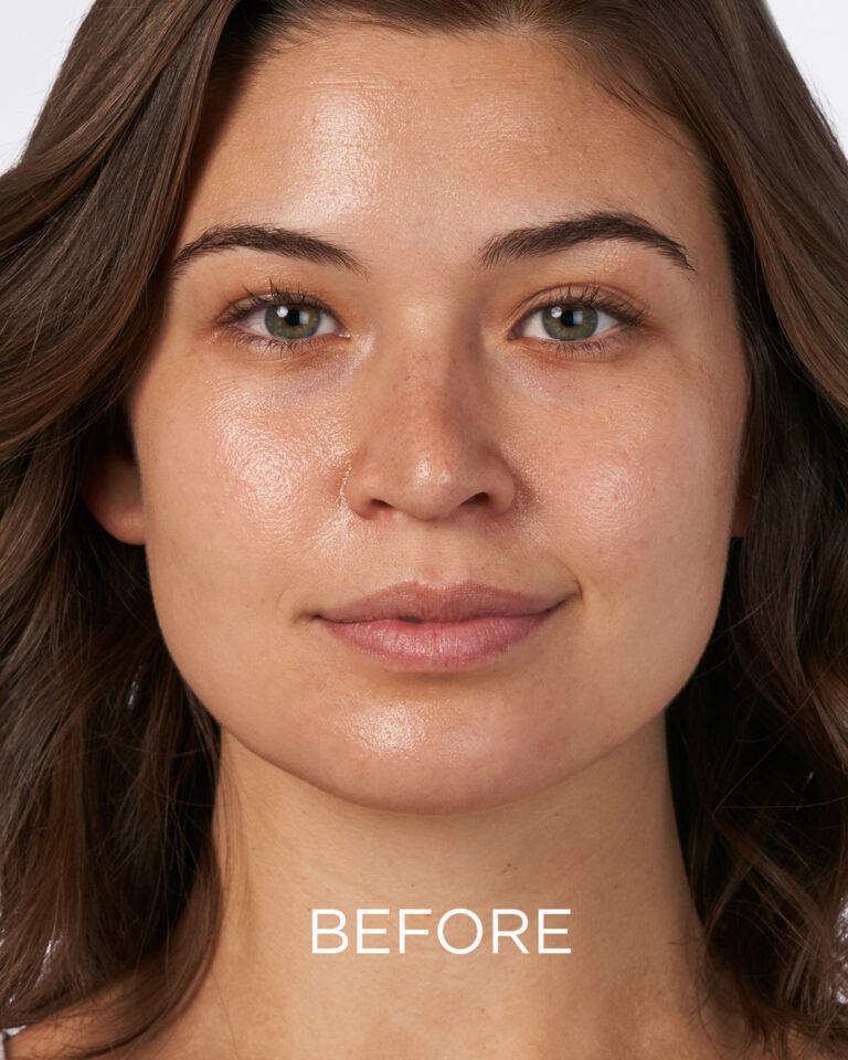 Billede til sociale medier NEOSTRATA Mandelic Clarifying Hydragel (before)