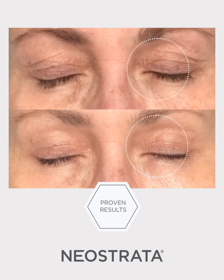 Billede til sociale medier NEOSTRATA Intensive Eye Therapy 7