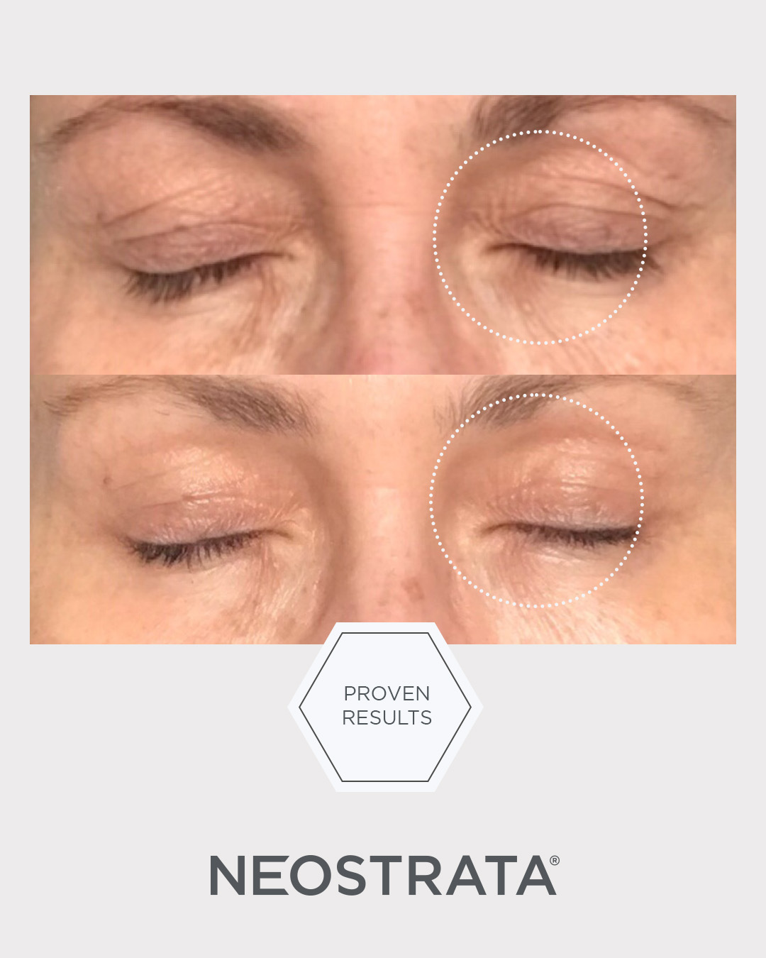 Billede til sociale medier NEOSTRATA Intensive Eye Therapy 7