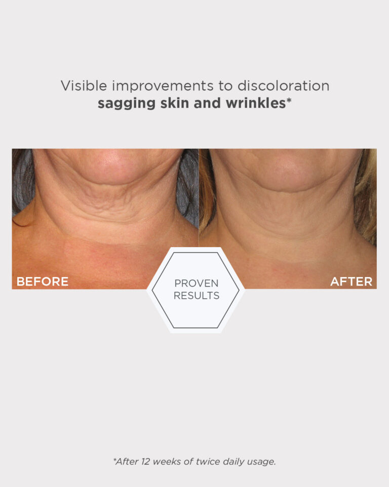 Billede til sociale medier NEOSTRATA Triple Firming Neck Cream 4