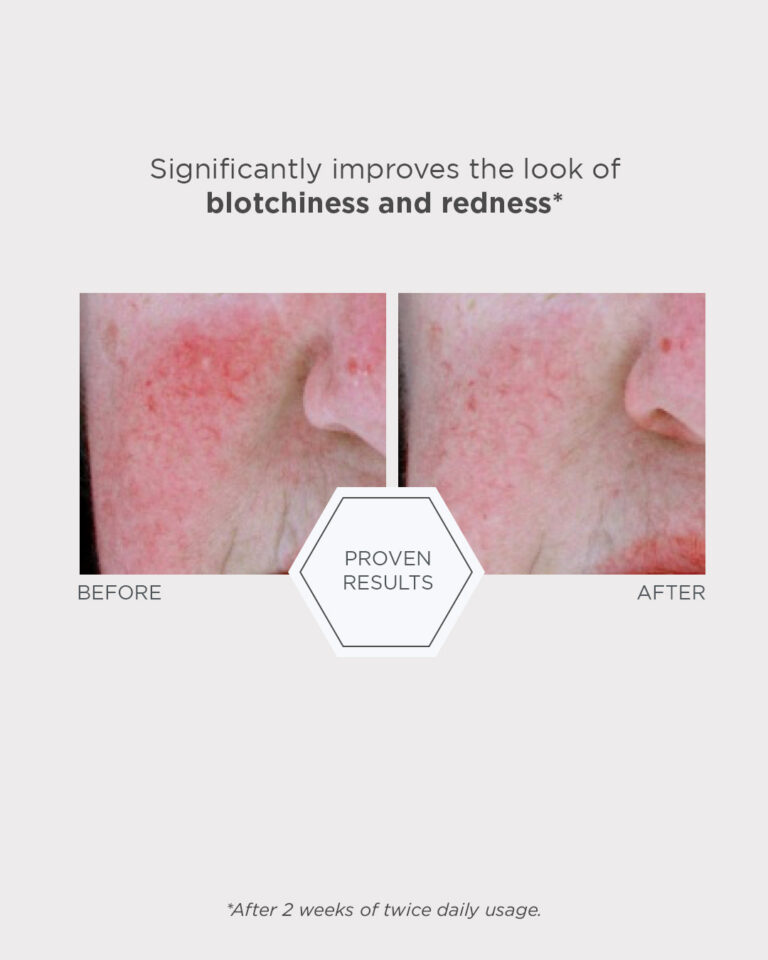 Billede til sociale medier NEOSTRATA Redness Neutralizing Serum 5