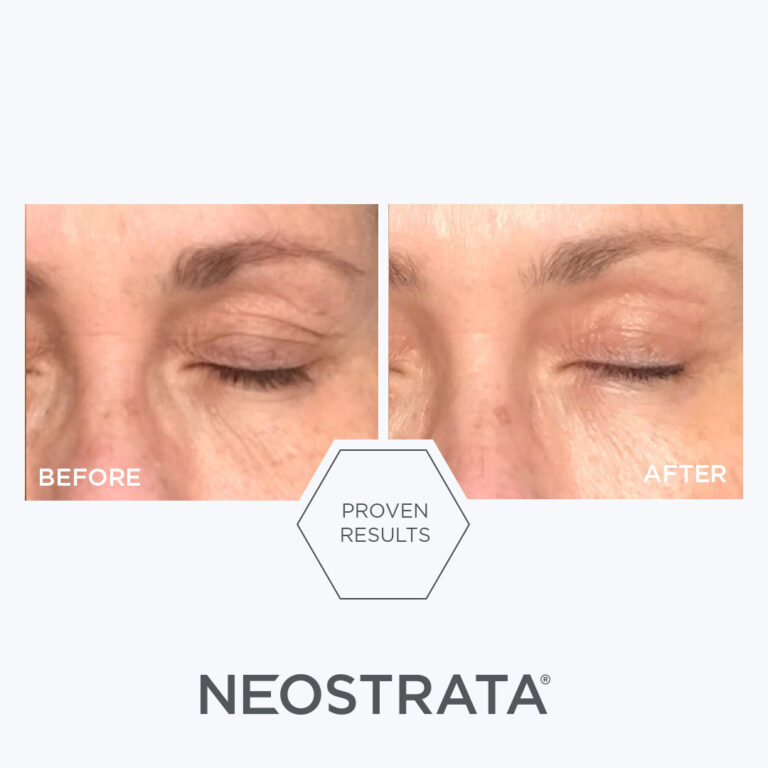 Billede til sociale medier NEOSTRATA Skin Active Intensive Eye Therapy 1