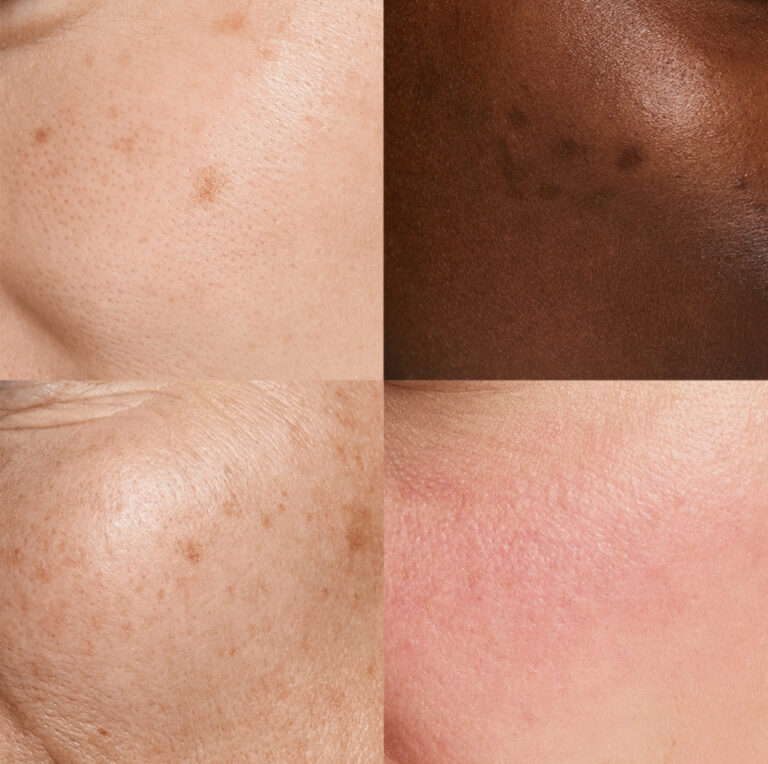 Billede til sociale medier NEOSTRATA hud