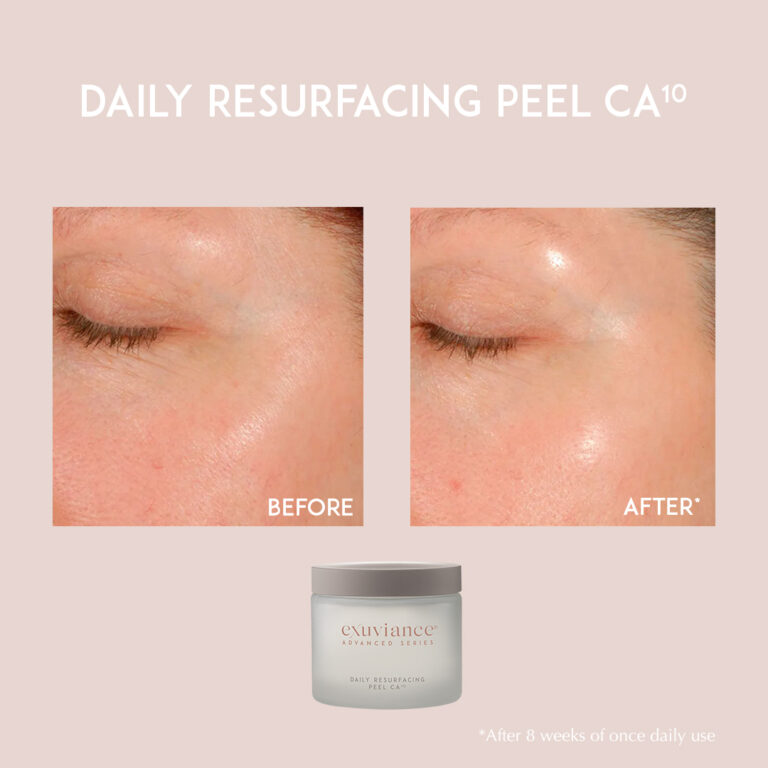 Billede til sociale medier Exuviance Daily Resurfacing Peel CA10 2