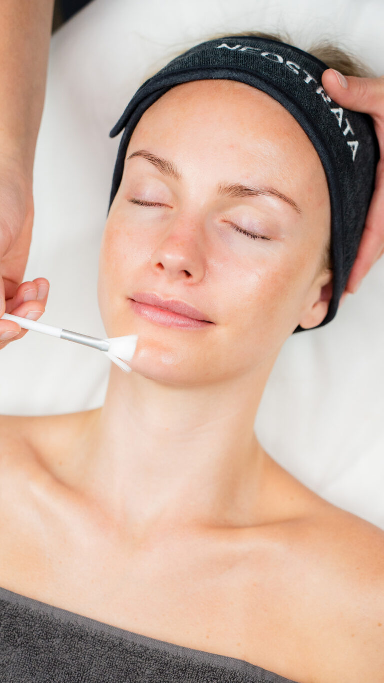 Billede til sociale medier NEOSTRATA behandling 4 story