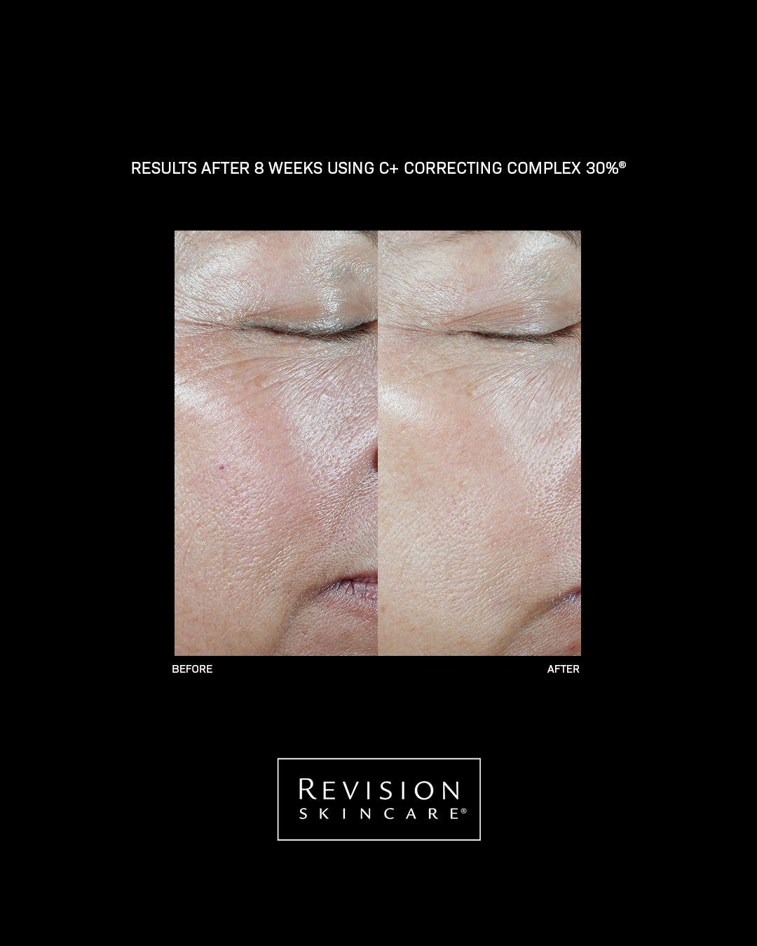 Billede til sociale medier Revision Skincare C Correcting